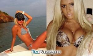 Анастасия Ковалева из Дома-2 – фото до и после пластических операций
