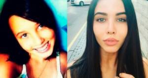 Anastasia Reshetova before and after