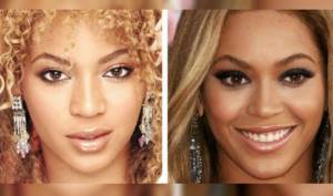 Beyonce before and after nose job (2000 vs 2010)