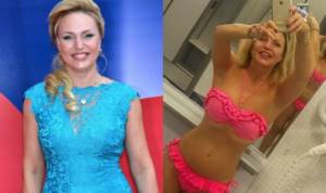 Photo of Alla Dovlatova before and after plastic surgery. Photo in a swimsuit 
