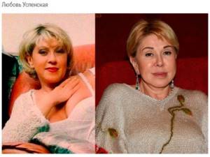 Photo of Lyubov Uspenskaya (singer) before and after plastic surgery