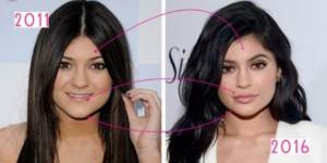 Kylie Jenner before and after plastic surgery: photo without makeup, photoshop, in a swimsuit, pregnant. How old, height, parameters, biography 