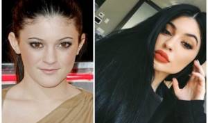 Kylie Jenner before and after plastic surgery: photo without makeup, photoshop, in a swimsuit, pregnant. How old, height, parameters, biography 