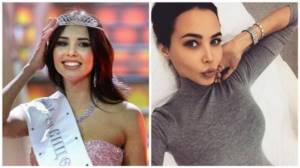 What kind of plastic surgery did Anastasia Reshetova, Timati’s girlfriend: photos before and after plastic surgery