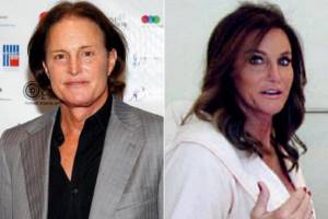 Caitlyn Jenner before and after
