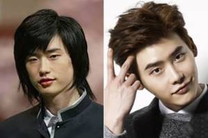Lee Jong Suk before and after plastic surgery