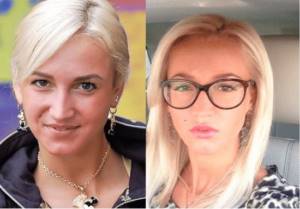 Olga Buzova - photos before and after plastic surgery of the nose, lips, cheekbones. How I lost weight, what plastic surgeries I did 