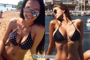 Victoria before and after breast surgery