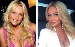 Victoria Lopyreva in her youth and after plastic surgery