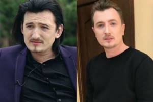 Vlad Kadoni before and after plastic surgery