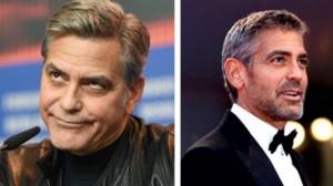 Perhaps these photos show George Clooney before and after plastic surgery