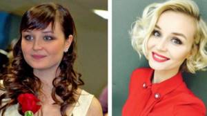 Perhaps Polina Gagarina had plastic surgery: before and after photos