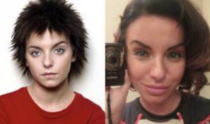 Yulia Volkova before and after plastic surgery